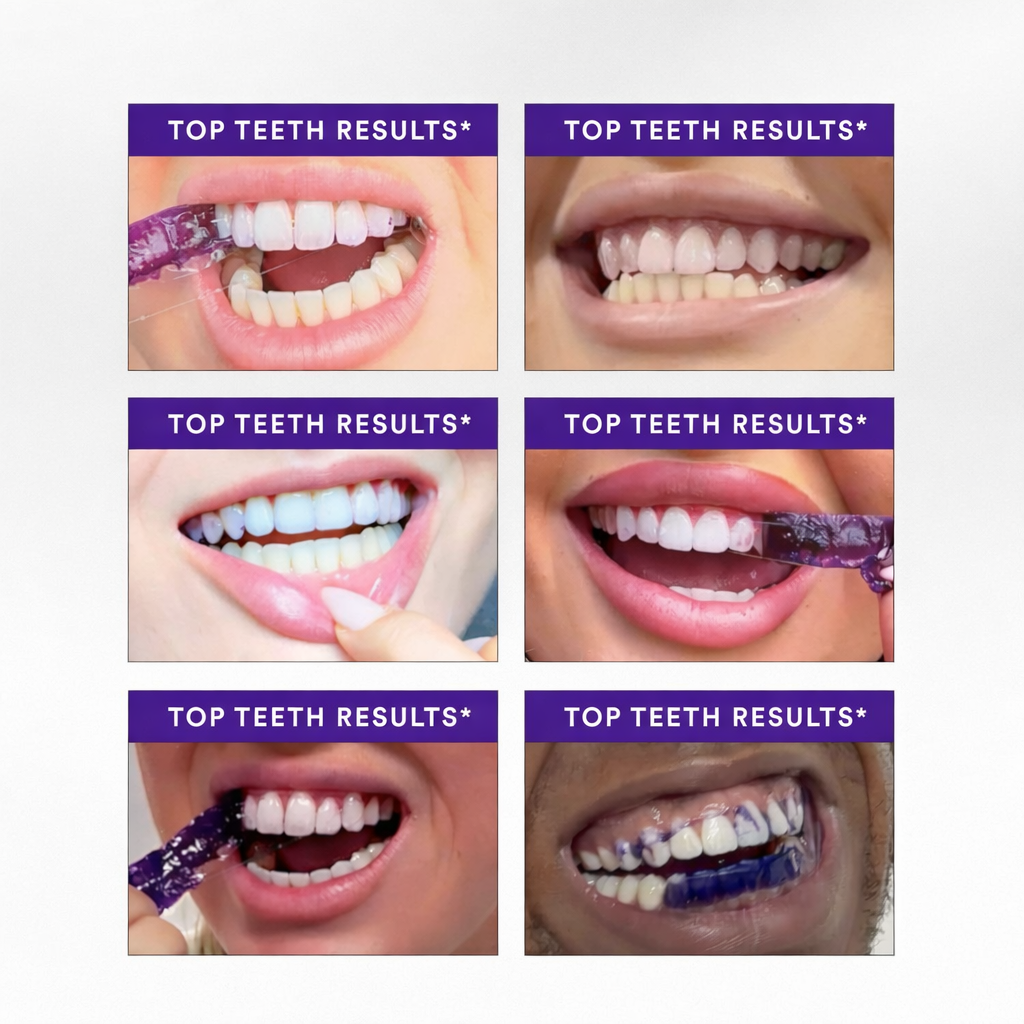 Purple Teeth Whitening Strips